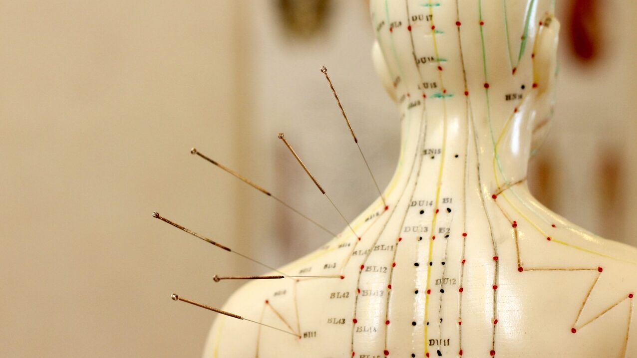 Servikal osteokondroz için akupunktur